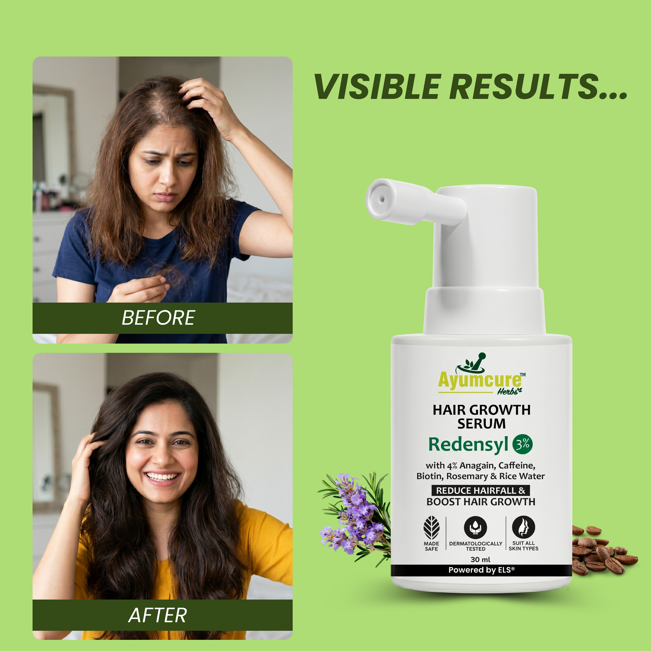 Hair Growth Serum | Biotin, Caffeine, Rice Water & Rosemary | Men & Women