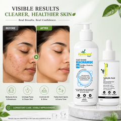 The Acne Clear Duo — 5% Niacinamide Face Wash + 2% Salicylic Acid Serum | Men & Women