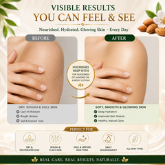 Winter Combo: Love & Glow Perfume Body Lotion + Almond Oil | Deep Moisturization | Unisex
