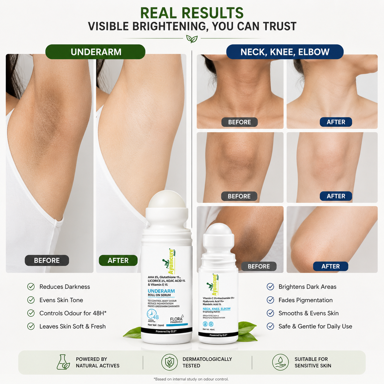The Dark Zone Duo — Neck, Knee & Elbow Roll-On + Underarm Roll-On | All Skin Types