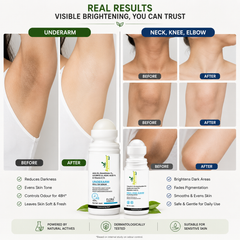 The Dark Zone Duo — Neck, Knee & Elbow Roll-On + Underarm Roll-On | All Skin Types