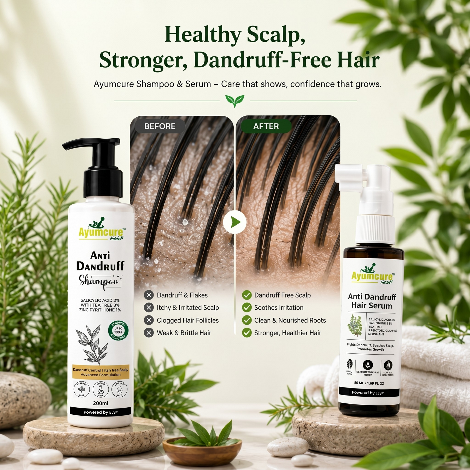 The Dandruff Fix Duo | Men & Women
