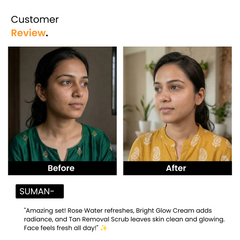 Glassy Glow Kit: Rose Water + Orange Scrub + Glutathione Cream | Men & Women