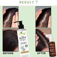 Anti-Dandruff Kit: 3% Tea Tree Shampoo + Niacinamide Serum | Men & Women