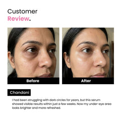 Anti-Dark Circle Serum with Niacinamide | Brightening | Men & Women