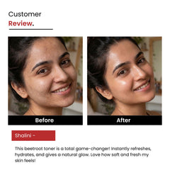 Beetroot Hyaluronic Face Mist & Toner | Glowing Skin | Unisex