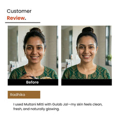 Face Pack Combo: Multani Mitti & Sandalwood + 3% Niacinamide + Rose Toner | Unisex