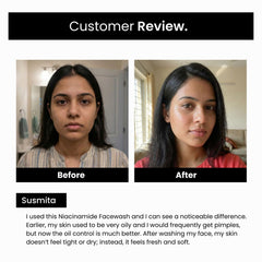5% Niacinamide Face Wash | Salicylic Acid, Glutathione & Zinc | Men & Women