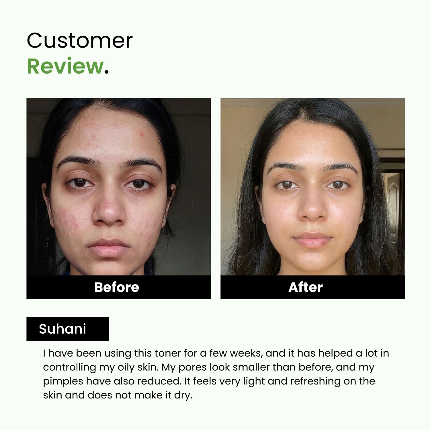 Green Tea & Niacinamide Pore-Tightening Face Toner | Normal & Oily Skin | Unisex