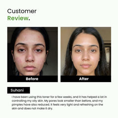 Green Tea & Niacinamide Pore-Tightening Face Toner | Normal & Oily Skin | Unisex