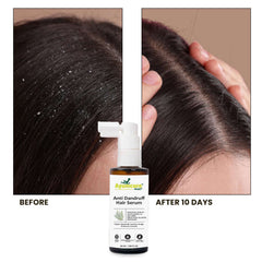 Anti-Dandruff Hair Serum | 2% Salicylic Acid, 3% Niacinamide & Tea Tree | Unisex