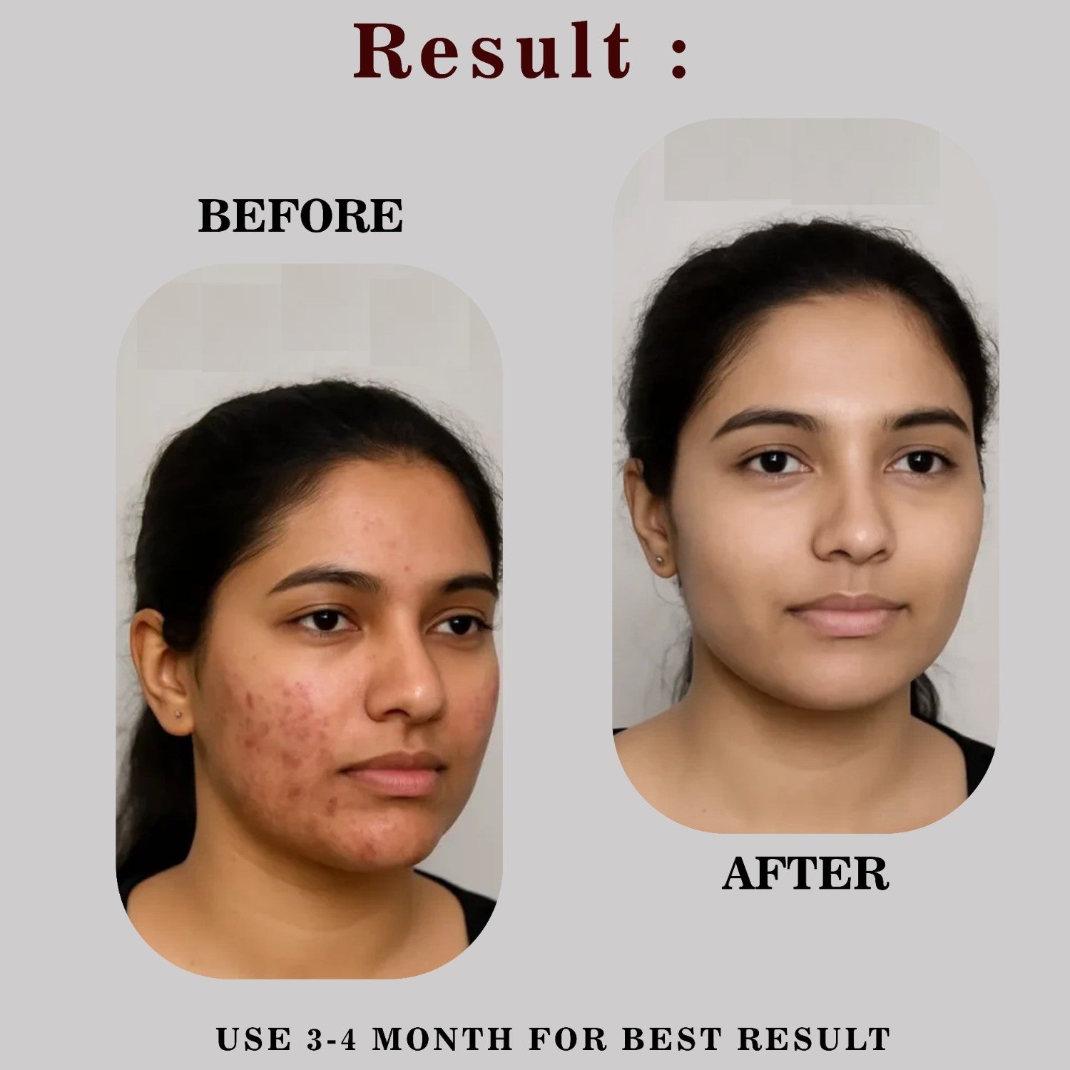 Instant Glow Combo: Multani Mitti + Rose Water + Vitamin C Serum | Men & Women