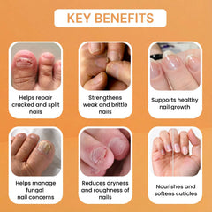 Nail Restore Serum | Repairs Weak, Brittle & Cracked Nails | Men & Women