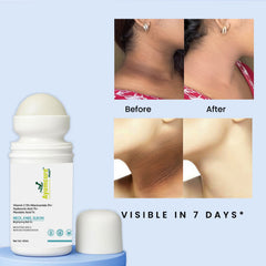 5% Niacinamide Roll-On | Fades Dark Spots on Neck, Knee & Elbow | All Skin Types