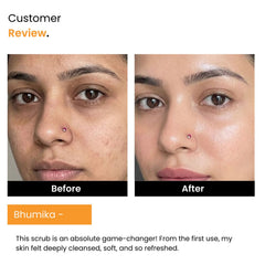 Orange Vitamin C Brightening Face Scrub | Tan Removal & Dead Skin | All Skin Types