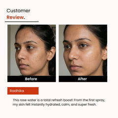 Pure Rose Water | Hydrating Face Toner, Alcohol-Free | Glowing Skin | Unisex