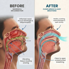 Anti-Snoring Herbal Nasal Drops | Promotes Peaceful Sleep | Men & Women