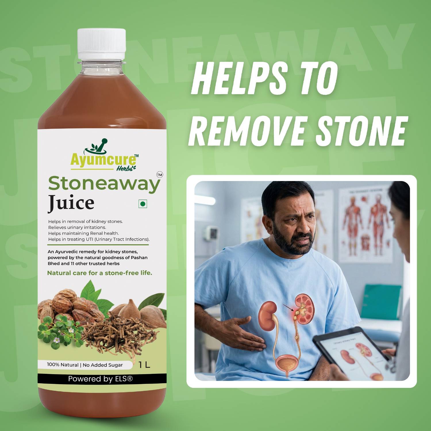 Stoneaway Juice | Pashan Bhed + Gokshura | Kidney Stone & UTI Support | Unisex