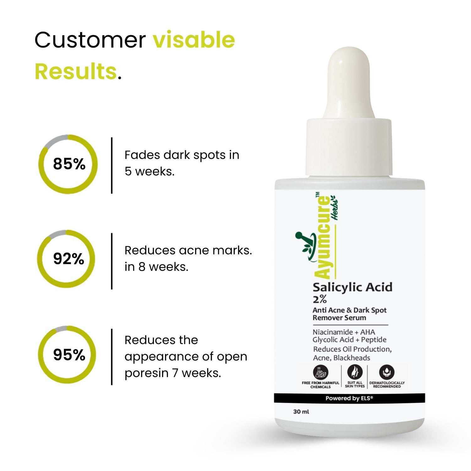 2% Salicylic Acid + 3% Niacinamide Serum | Acne, Blackheads & Dark Spots | Unisex