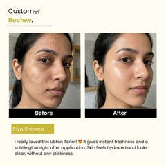 Ubtan Glow Toner | 3% Niacinamide, Saffron & Chandan | Brightening | All Skin Types
