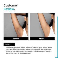 Underarm Brightening Spray | Niacinamide & Glycolic Acid | Fades Dark Spots | Unisex