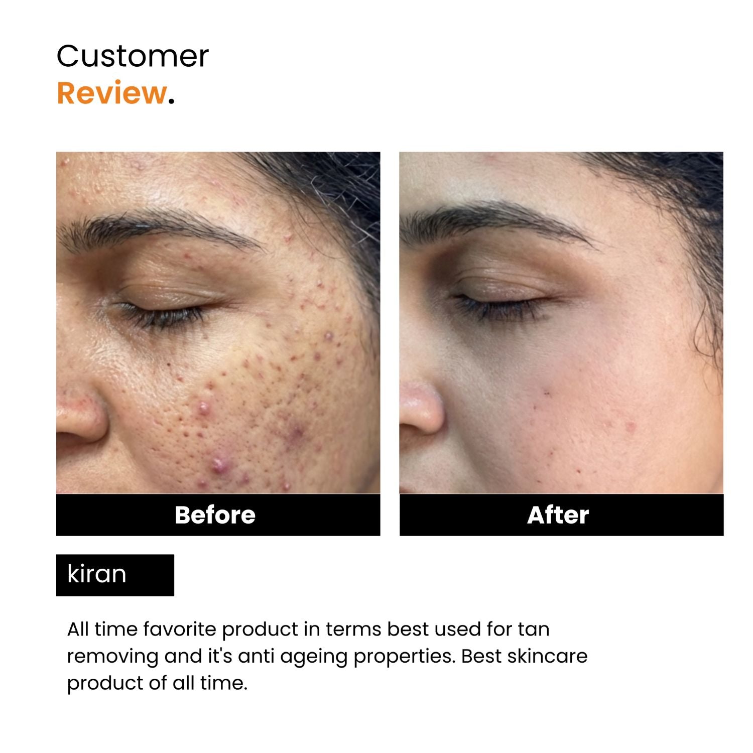 Vitamin C Face Serum | Ferulic Acid, Hyaluronic Acid & Vit E | Anti-Aging | Unisex