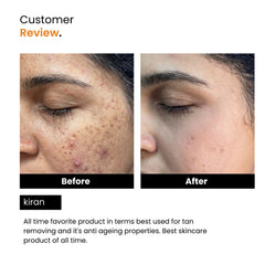 Vitamin C Face Serum | Ferulic Acid, Hyaluronic Acid & Vit E | Anti-Aging | Unisex