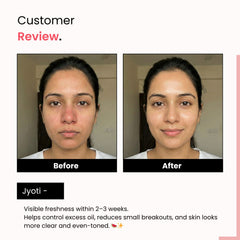 Watermelon Cooling Toner | 3% Niacinamide | Unclogs Pores & Refines Texture | Unisex